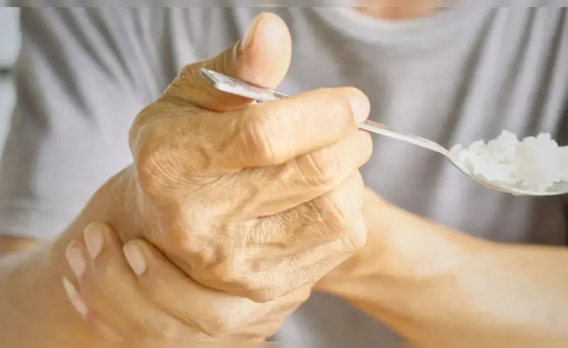 Parkinson en Perú: el tiempo perdido antes del diagnóstico que empeora la enfermedad