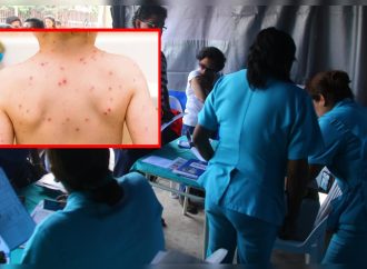Alerta epidemiológica en Perú ante posible reingreso del sarampión por avance regional del virus