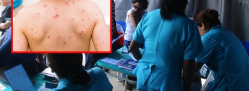 Alerta epidemiológica en Perú ante posible reingreso del sarampión por avance regional del virus