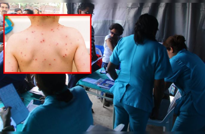 Alerta epidemiológica en Perú ante posible reingreso del sarampión por avance regional del virus